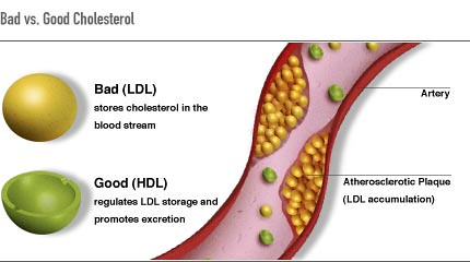"máu nhiễm mỡ - cholesterol" by LÊ VĂN THẢO is licensed under CC BY-SA 2.0 Illustration, with labels, showing bad versus good cholesterol
